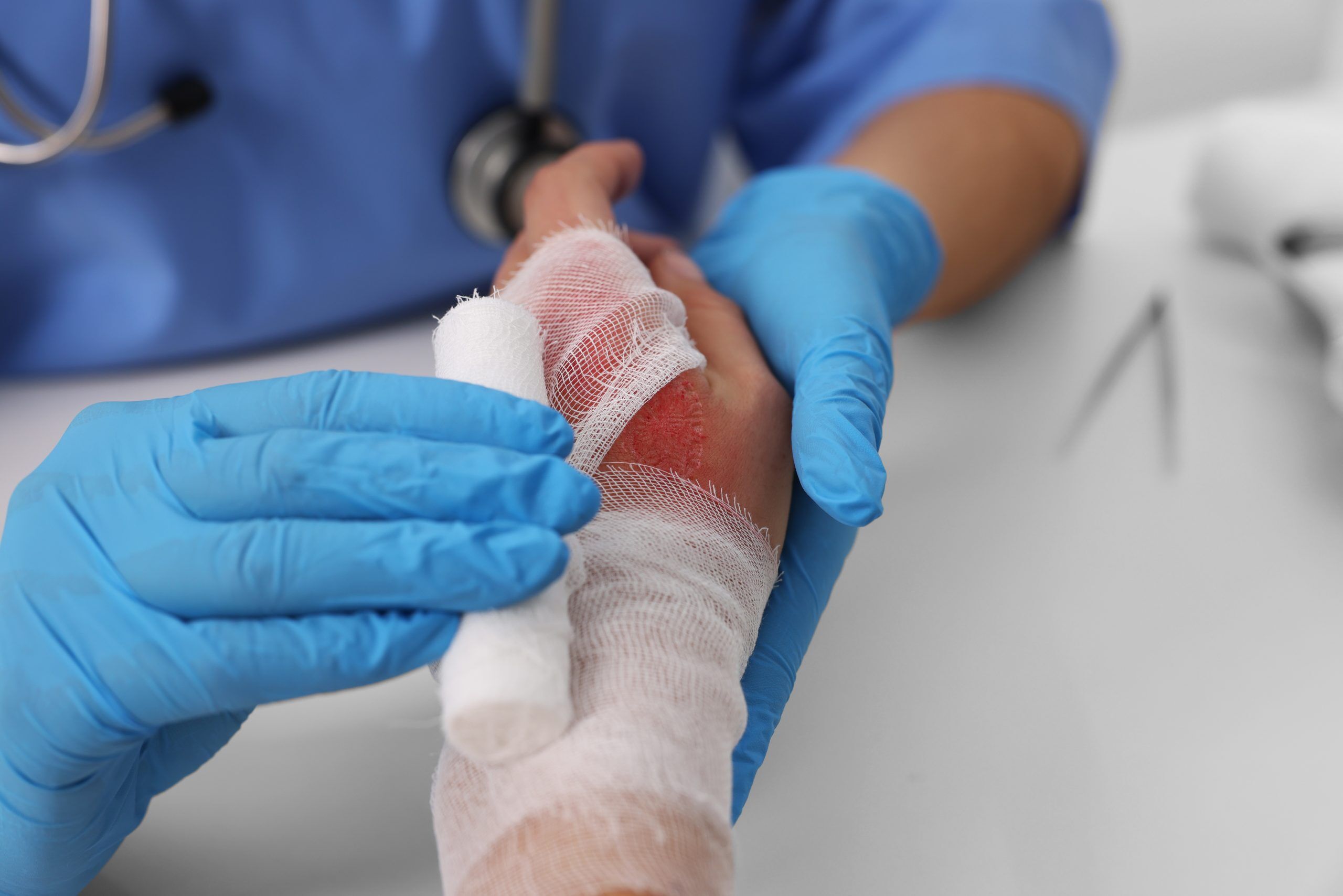 Explosion Injuries — AZ Burn Lawyers